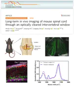 Nat Commun | 瞿佳男组发现小鼠脊髓长期微创高分辨成像新方法