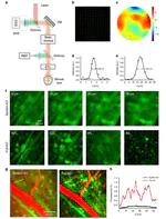 March 2020: Our manuscript on adaptive optics microscopy for near-diffraction-limited and functional retinal imaging is accepted for publication in Nature-Light: Science and Applications. Congratulations to Zhongya, Sicong and all co-authors!