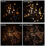 September 2020: In the news of "Two-photon endomicroscopy allows deep-brain imaging" 