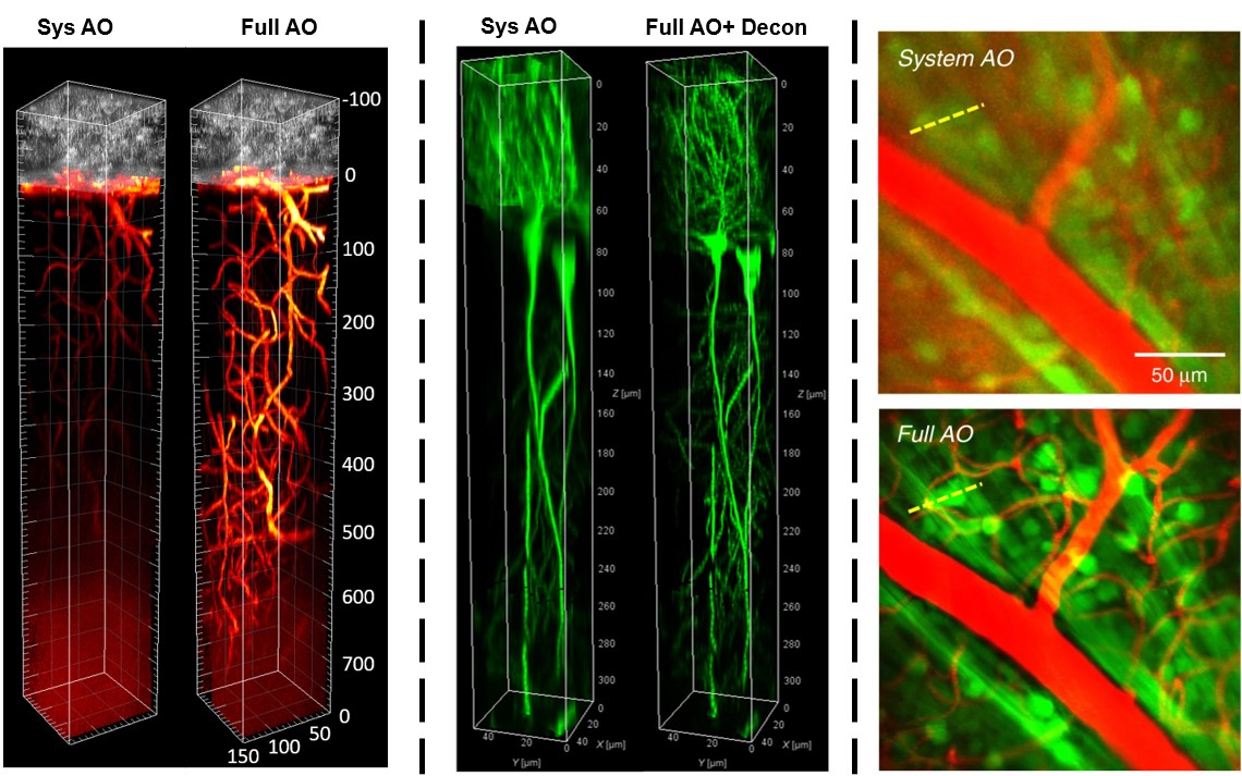 Microscopy Ophthalmic Imaging Dynamic Optics - vrogue.co